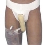 picture showing the mcguire male urinal on a male with a belt around the waist connected to what looks like a jock strap with a condom sticking out the front connected to a tube which goes to a urine collection bag on the thigh